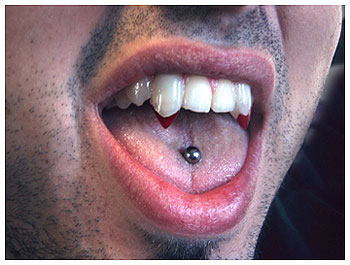 Blood Tip Vampire Fangs