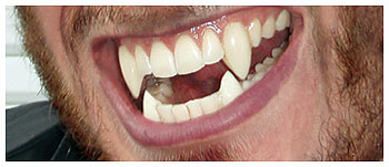 Adult Werewolf Teeth - Click Image to Close