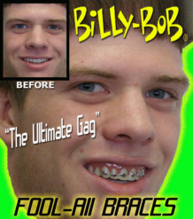 Billy-Bob Teeth - Braces